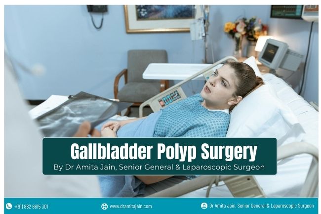 Top Gallbladder Polyp Surgeon in Delhi Dr Amita Jain